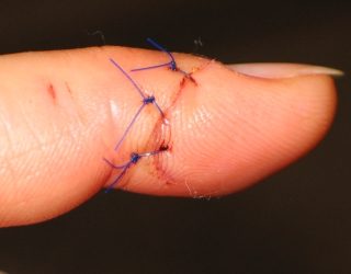 finger 1